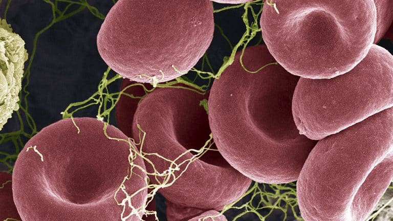 Korona virus i vakcine: AstraZeneka i krvni ugrušci – sve što treba da znate