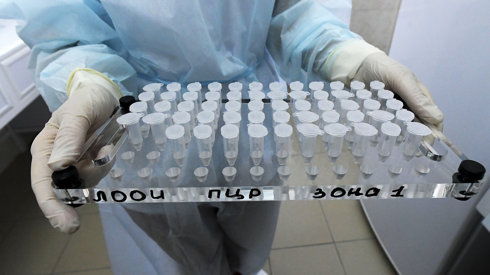 Više od 5.000 novozaraženih koronavirusom, preminulo još 8 osoba