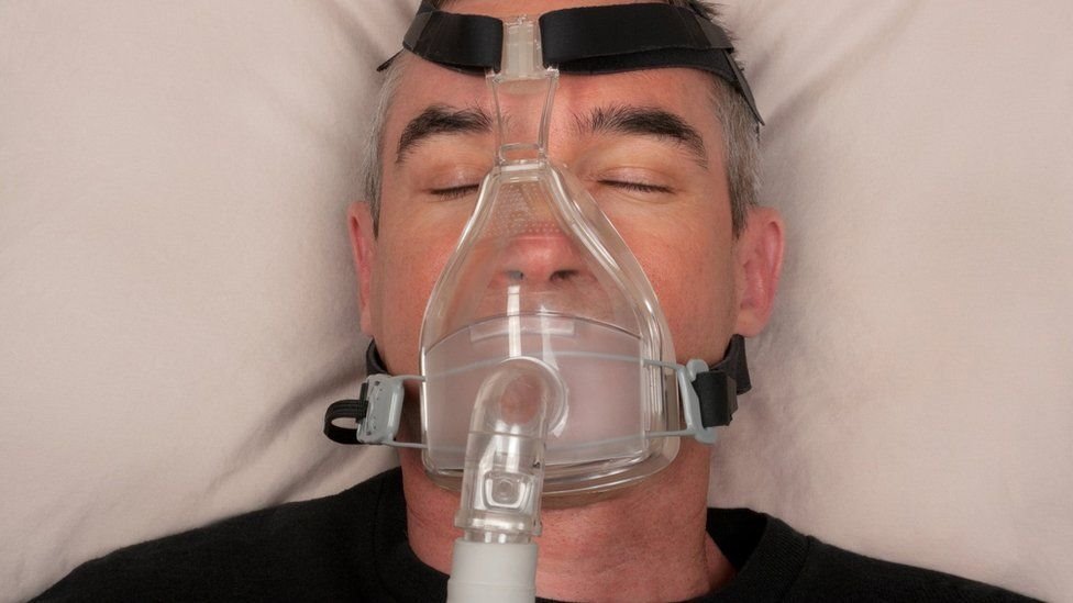 Veštačka pluća i korona virus: Kako radi mašina koja diše umesto pacijenta