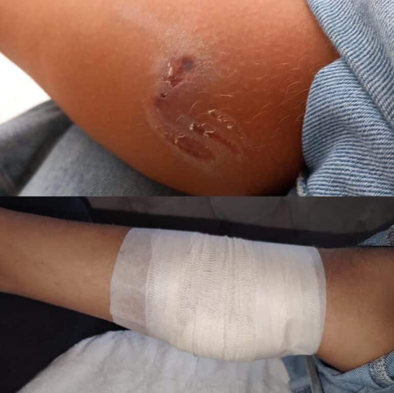 Još jedan napad psa na dete u Novom Pazaru, od azila još uvek ništa (VIDEO+FOTO)